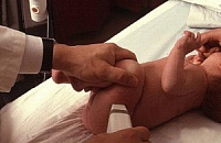 Консультация детского ортопеда